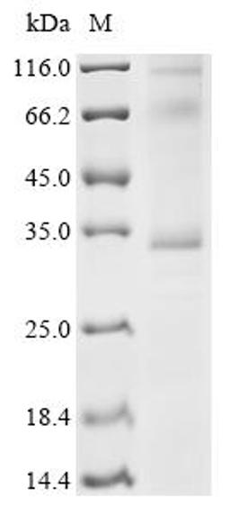 (Tris-Glycine gel) Discontinuous SDS-PAGE (reduced) with 5% enrichment gel and 15% separation gel.