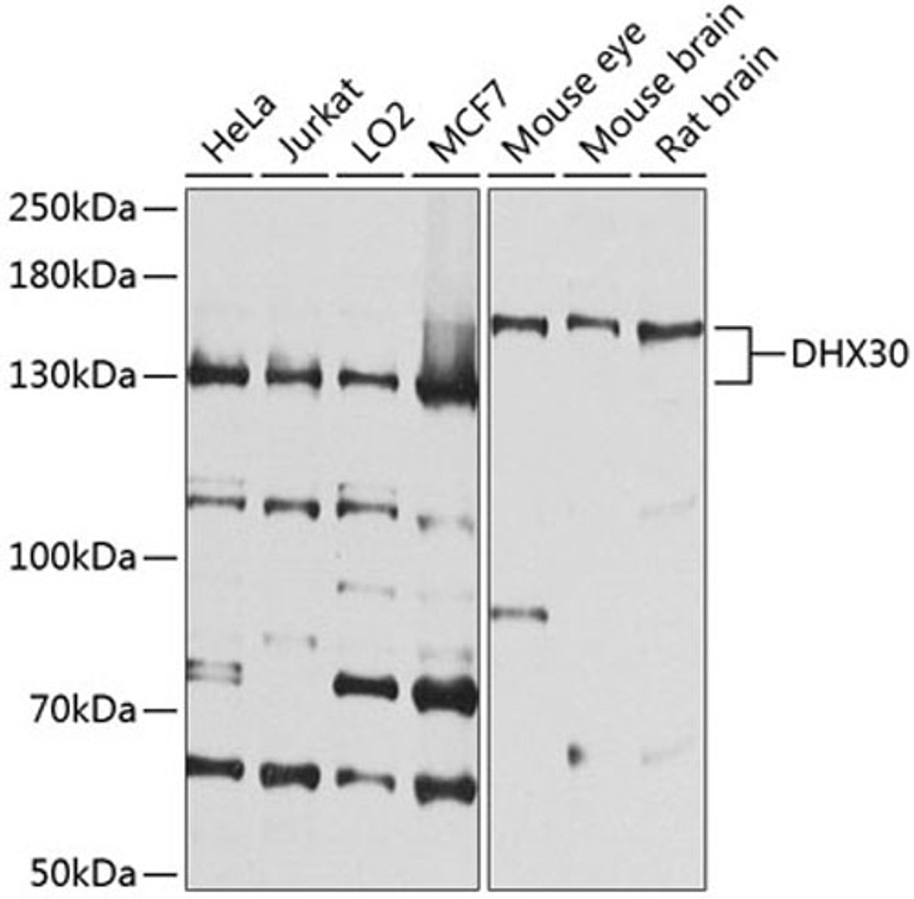 Western blot - DHX30 antibody (A8575)