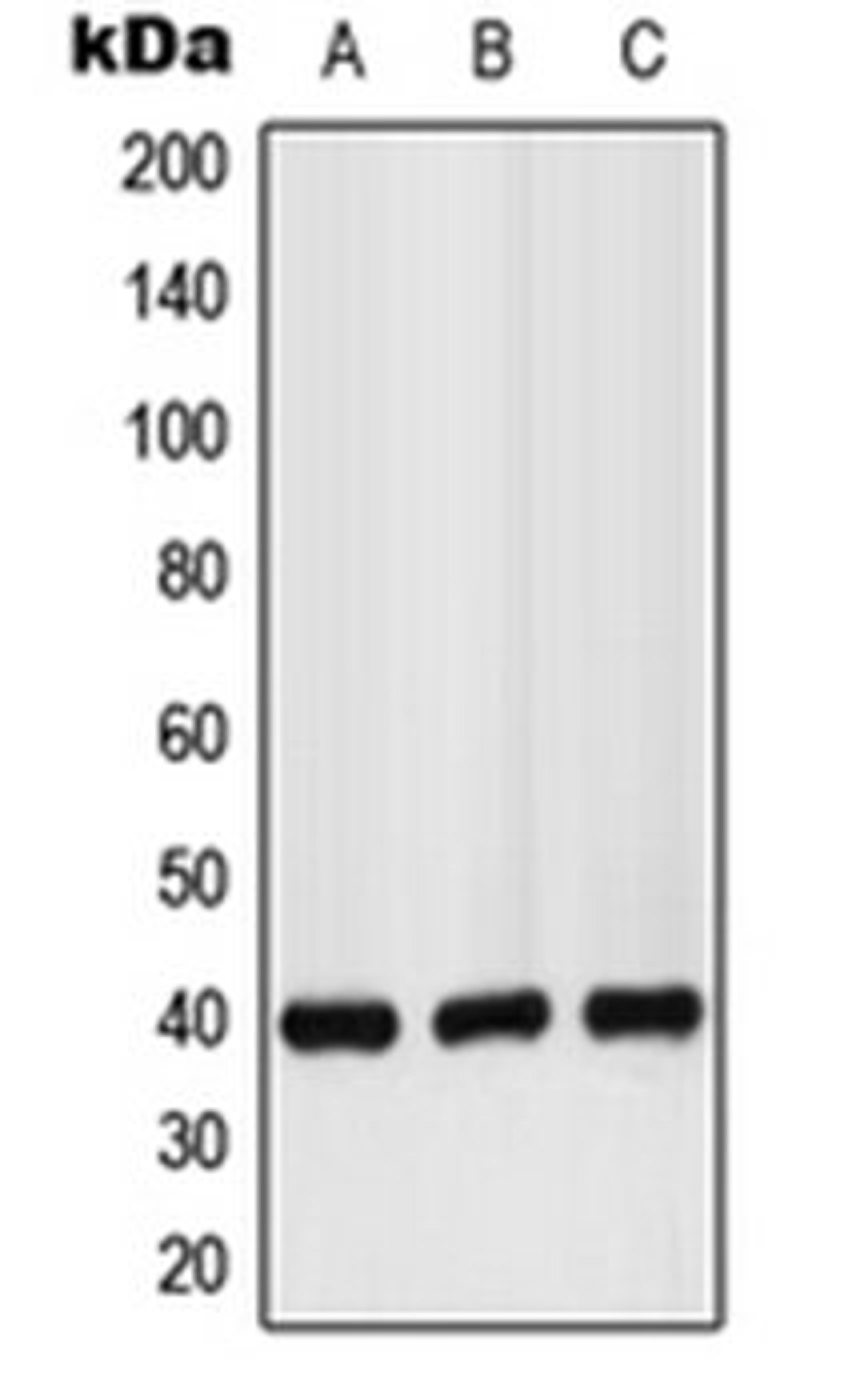 Western blot analysis of LO2 (Lane 1), mouse liver (Lane 2), rat kidney (Lane 3) whole cell lysates using GPR160 antibody