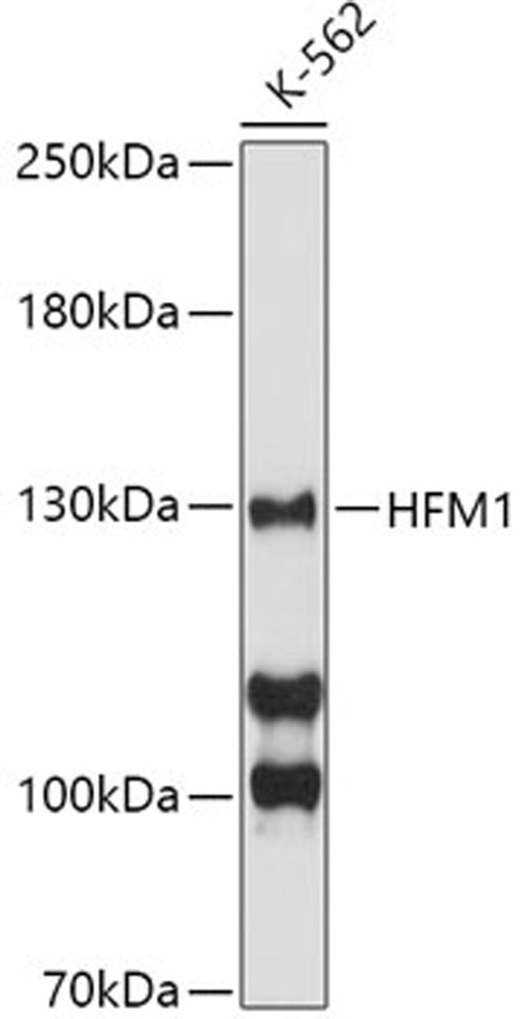 Western blot - HFM1 antibody (A8600)