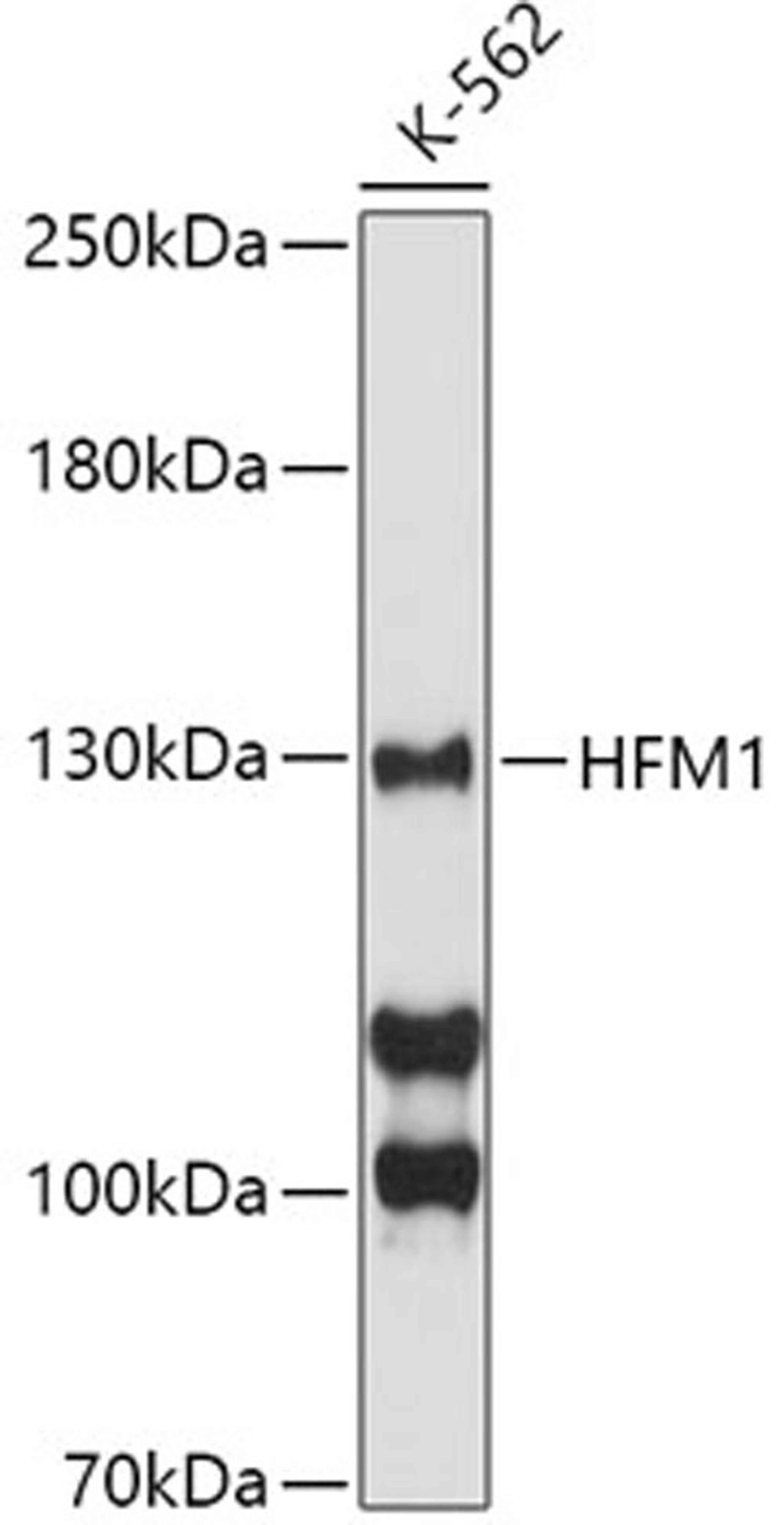 Western blot - HFM1 antibody (A8600)