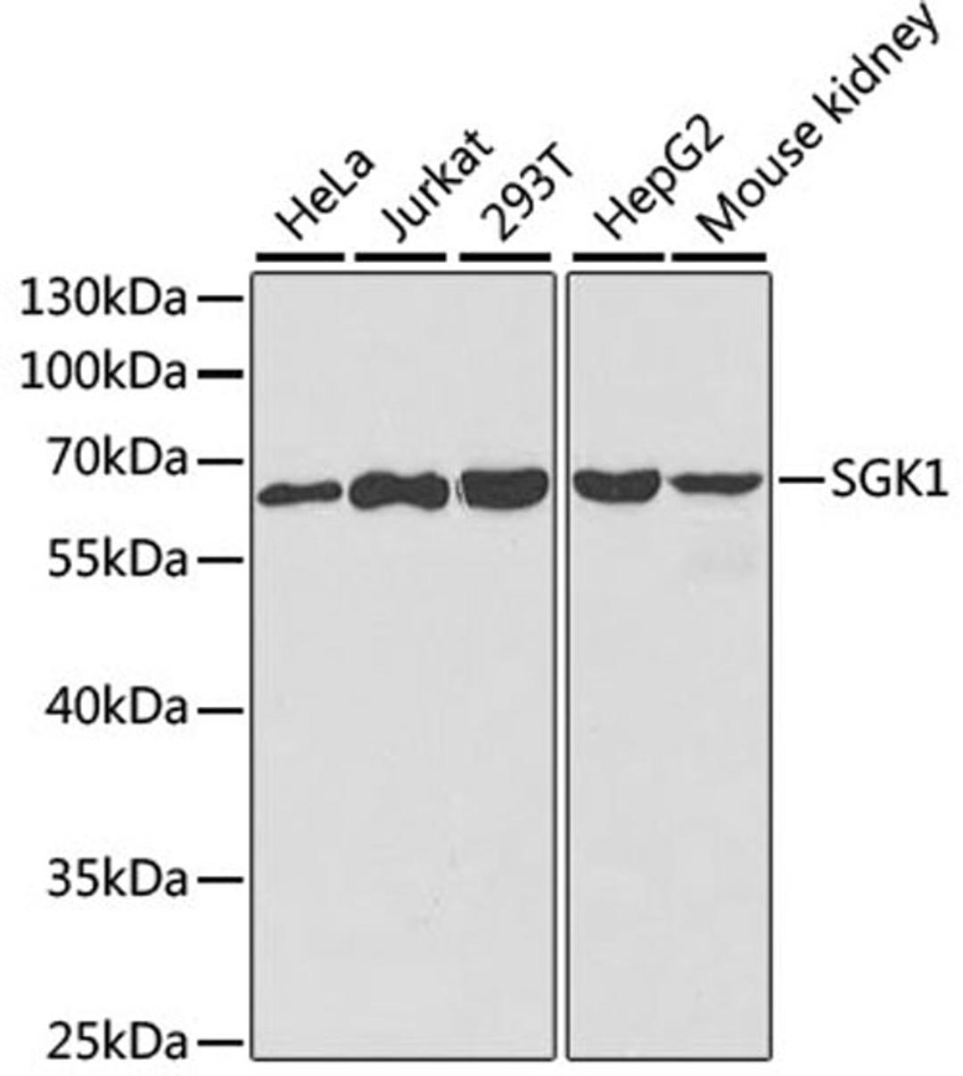 Western blot - SGK1 antibody (A1025)