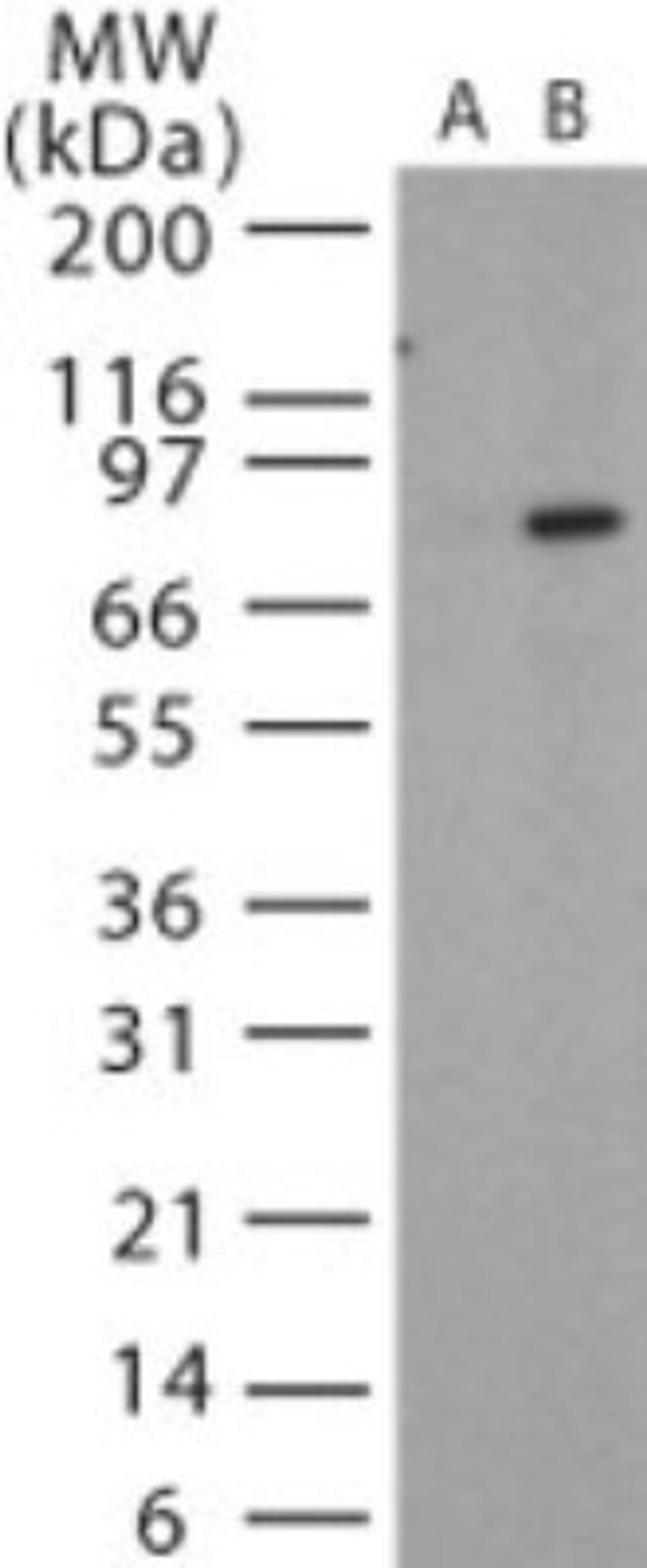 Western Blot: Anthrax PA Antibody [NB100-56670] - Analysis using the Azide Free version of NB100-56670. Detection of Anthrax PA in recombinant protein using this antibody. Lane A shows the pre-bleed.