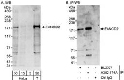 Detection of human FANCD2 by western blot and immunoprecipitation.