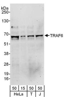 Detection of human TRAF6 by western blot.