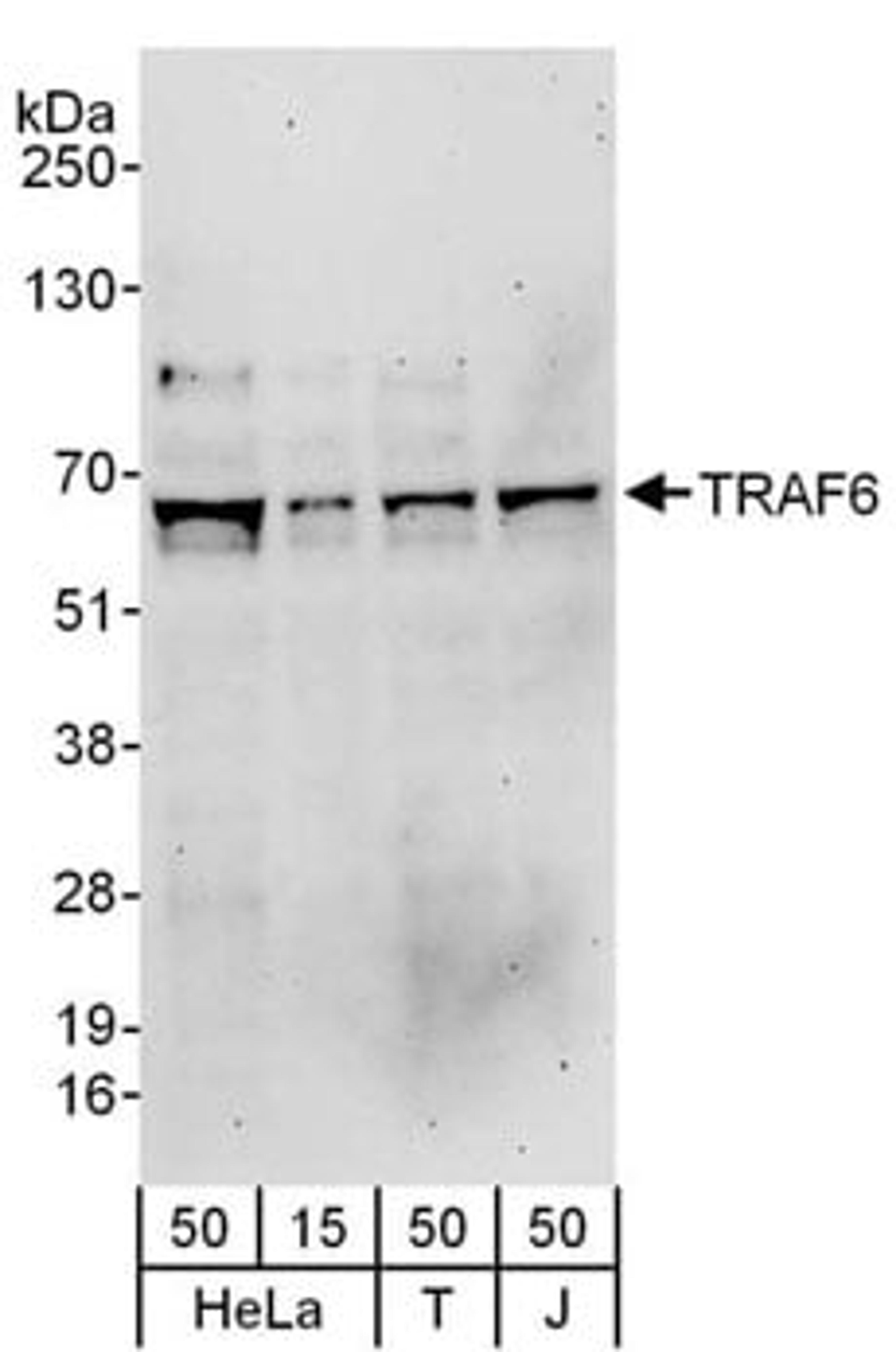 Detection of human TRAF6 by western blot.