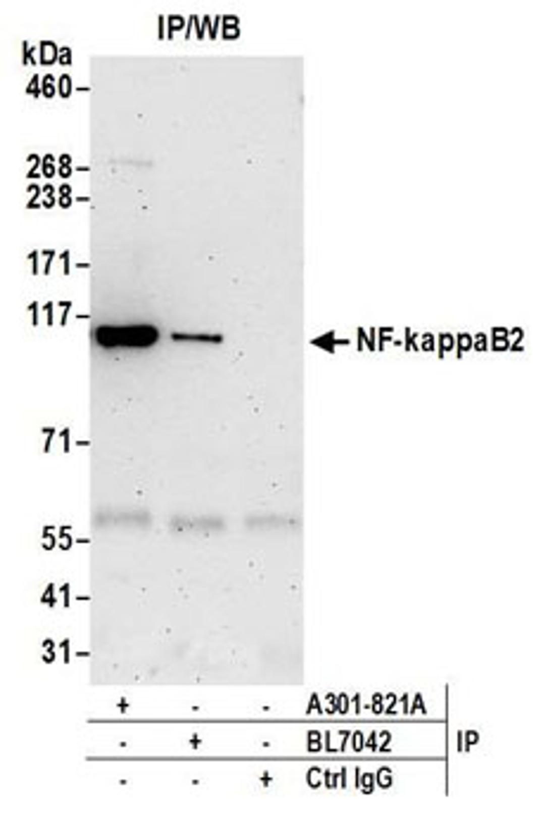 Detection of human NF-kappaB2 by western blot of immunoprecipitates.