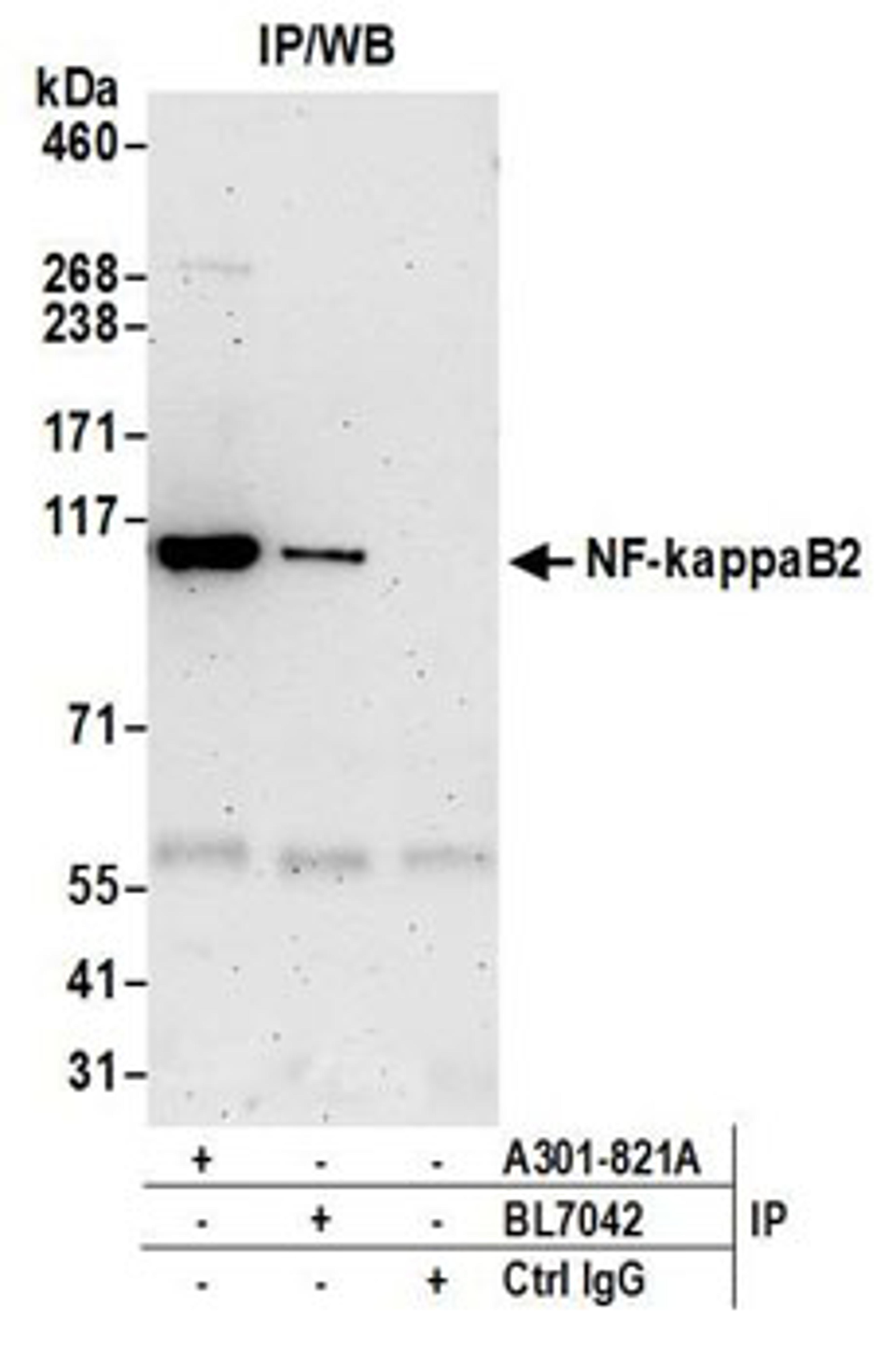 Detection of human NF-kappaB2 by western blot of immunoprecipitates.