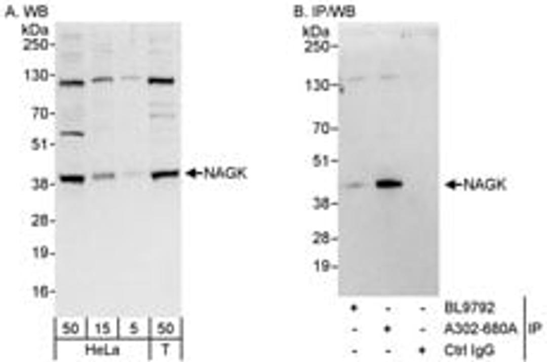 Detection of human NAGK by western blot and immunoprecipitation.