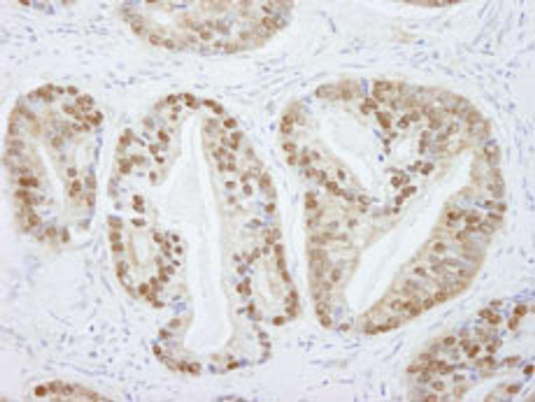 Detection of human PRMT5 by immunohistochemistry.