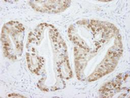 Detection of human PRMT5 by immunohistochemistry.