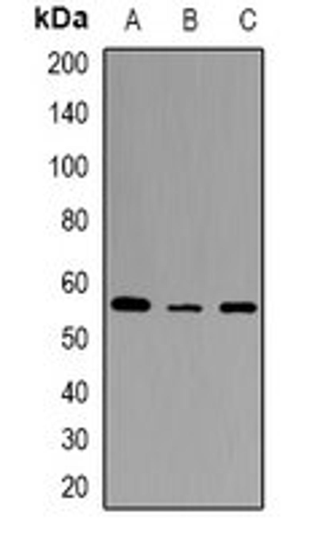 Western blot analysis of HEK293T (Lane1), mouse spleen (Lane2), rat spleen (Lane3) whole cell lysates using STEAP2 antibody