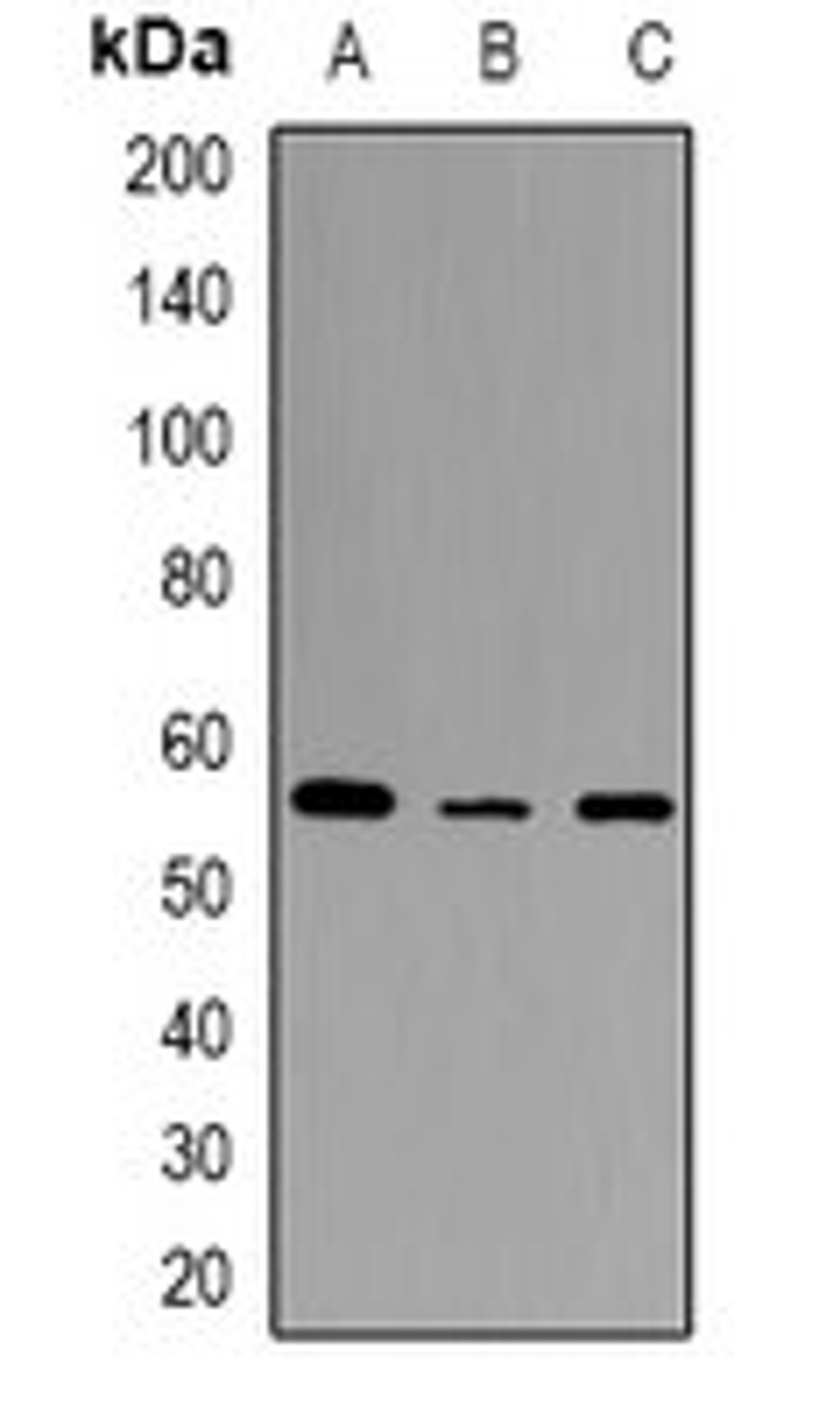 Western blot analysis of HEK293T (Lane1), mouse spleen (Lane2), rat spleen (Lane3) whole cell lysates using STEAP2 antibody