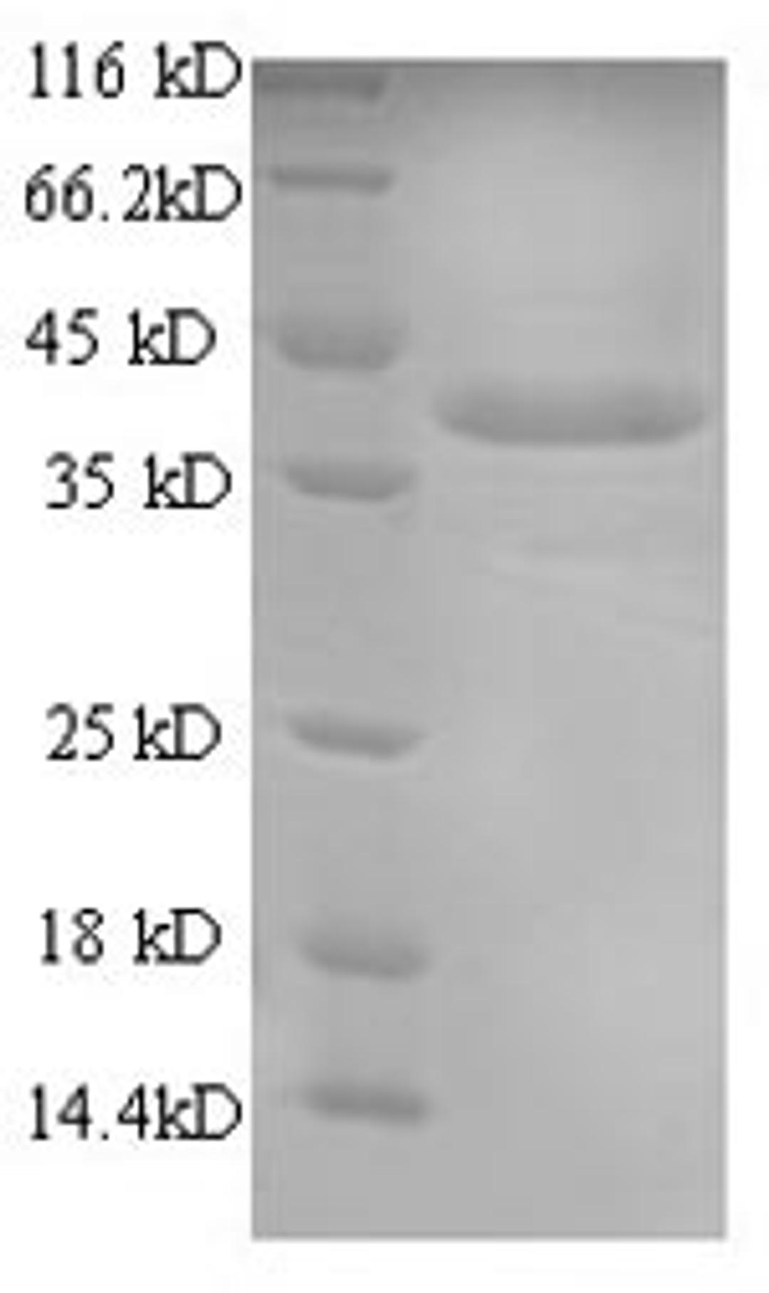 (Tris-Glycine gel) Discontinuous SDS-PAGE (reduced) with 5% enrichment gel and 15% separation gel.