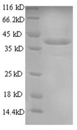 (Tris-Glycine gel) Discontinuous SDS-PAGE (reduced) with 5% enrichment gel and 15% separation gel.