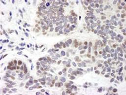 Detection of human ZNF261 by immunohistochemistry.