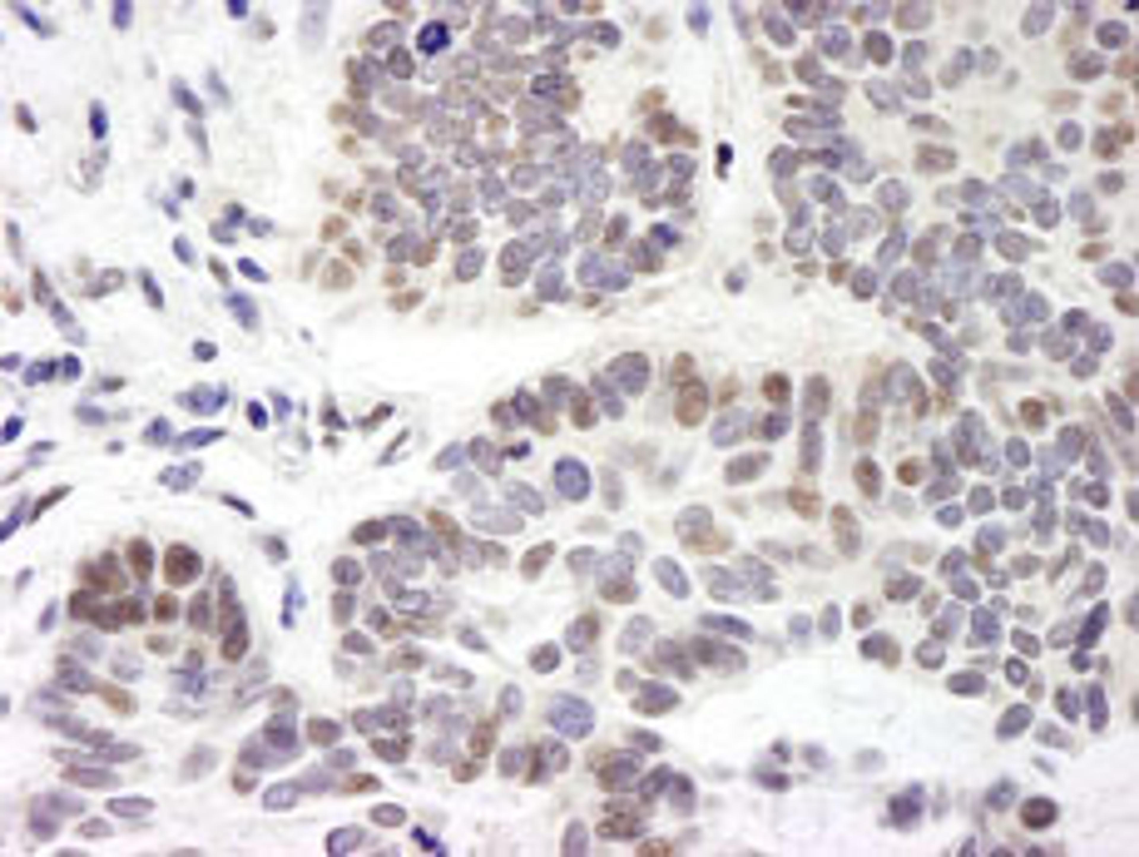 Detection of human ZNF261 by immunohistochemistry.