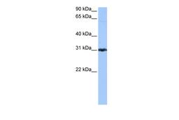 Antibody used in WB on Human Jurkat 0.2-1 ug/ml.