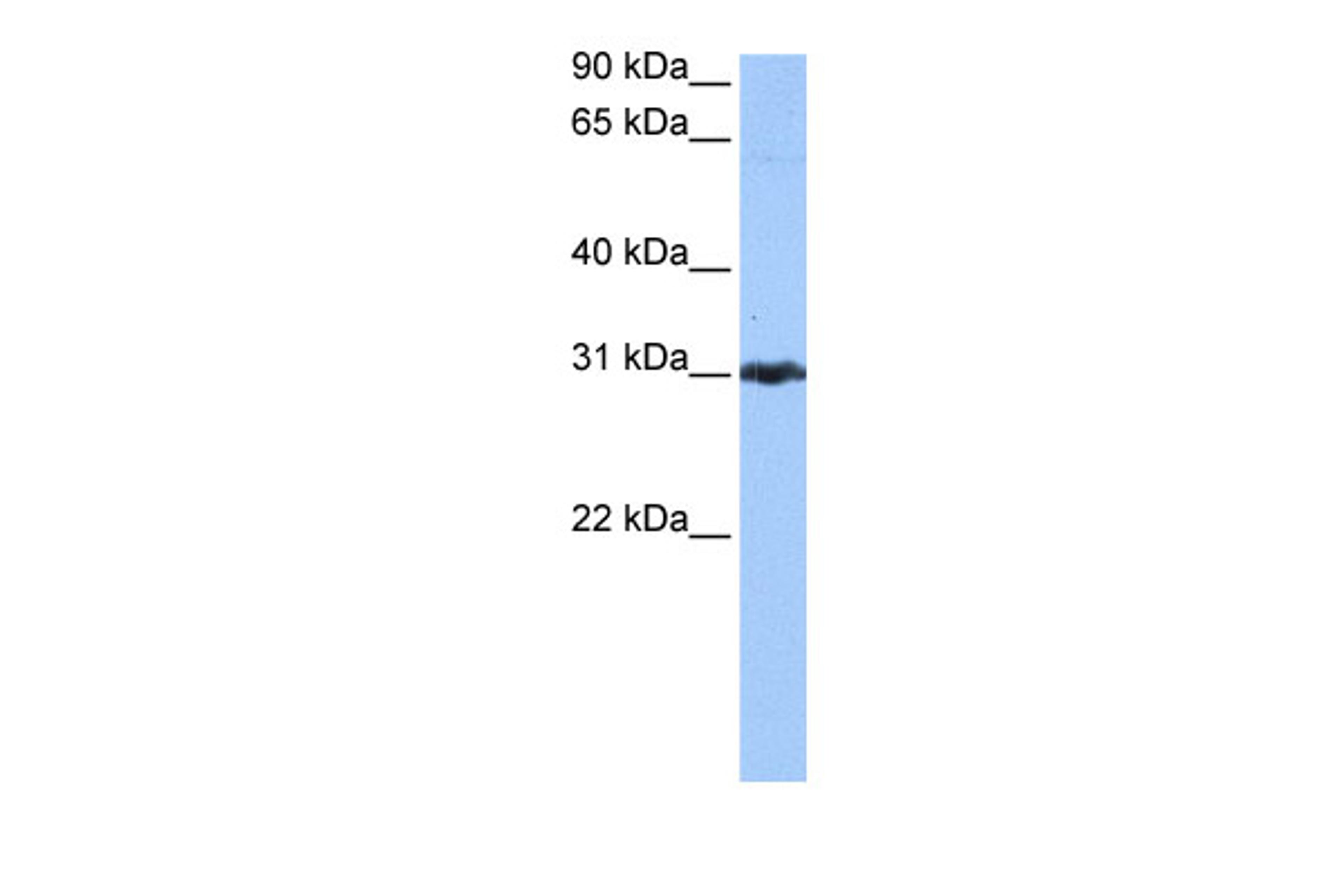 Antibody used in WB on Human Jurkat 0.2-1 ug/ml.