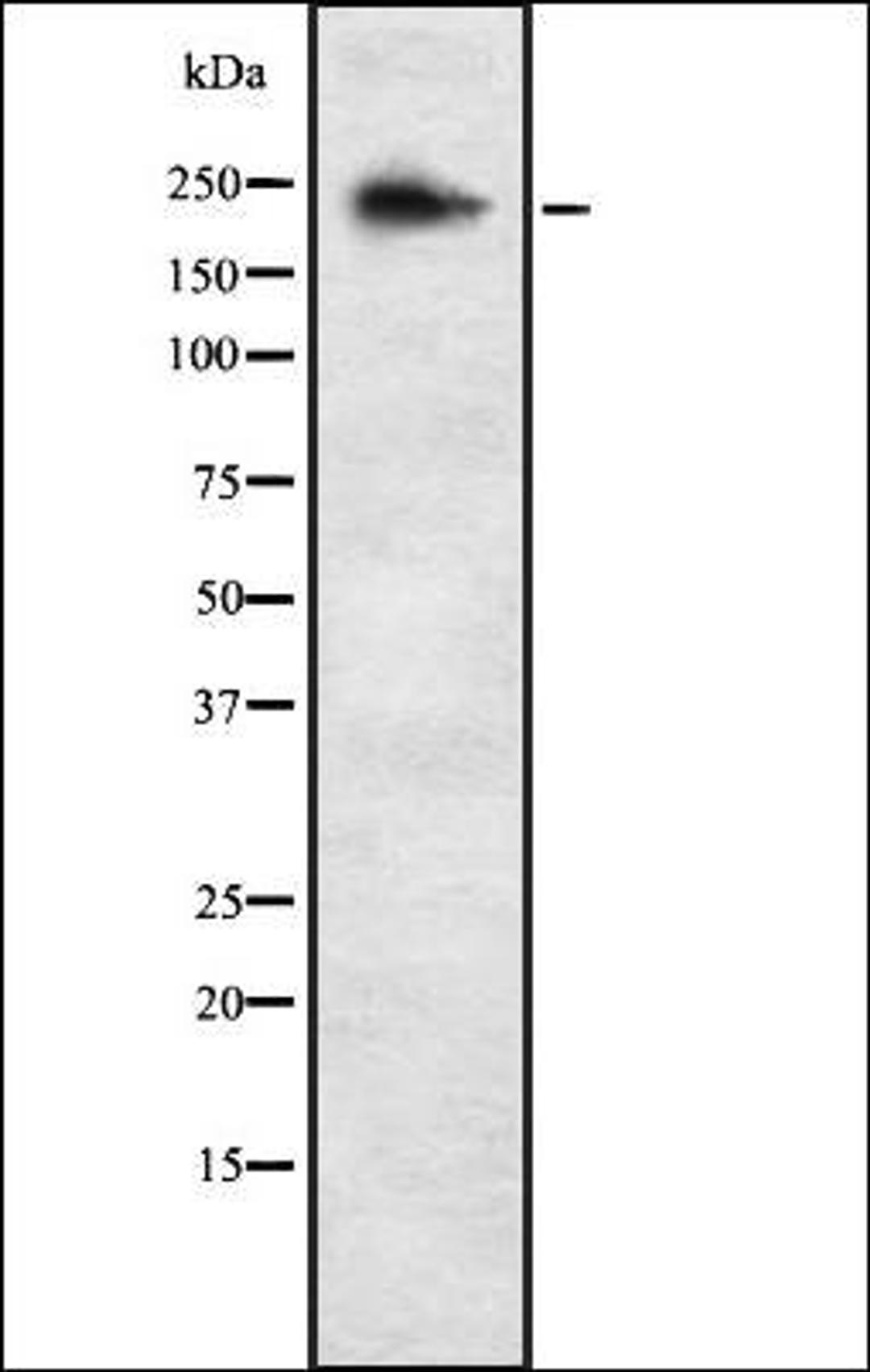 Western blot analysis of K562 whole cell lysates using ALPK3 antibody