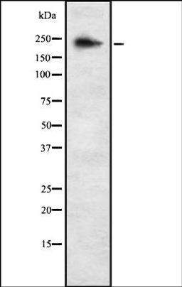 Western blot analysis of K562 whole cell lysates using ALPK3 antibody