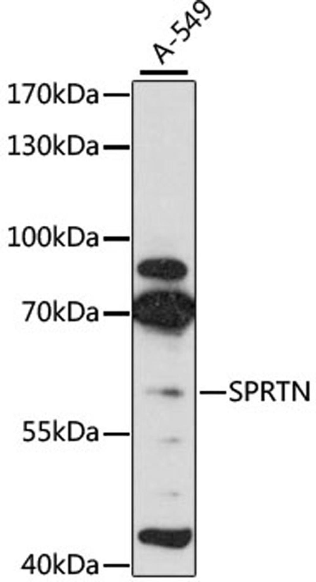 Western blot - SPRTN antibody (A11663)