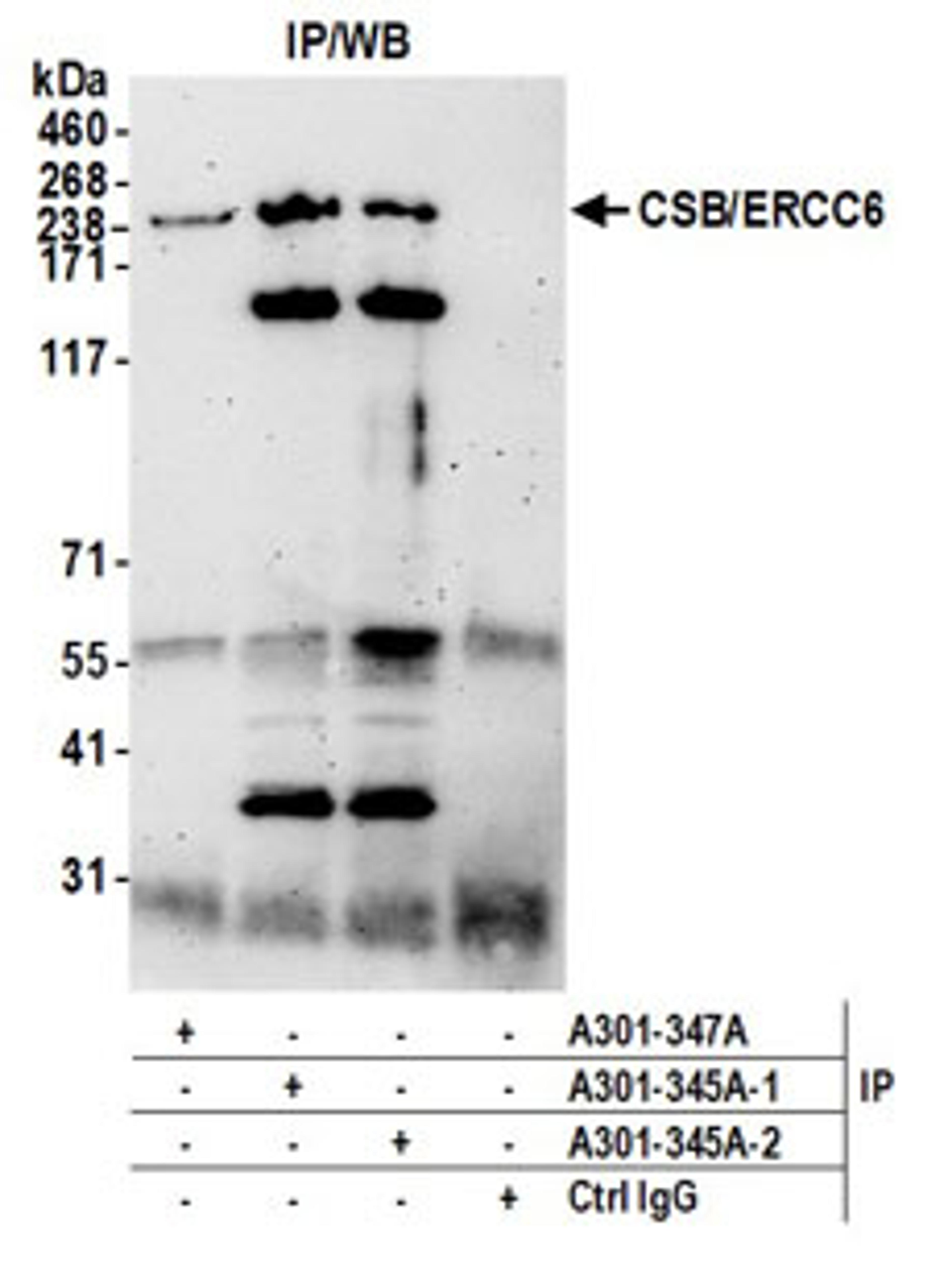 Detection of human CSB/ERCC6 by western blot of immunoprecipitates.