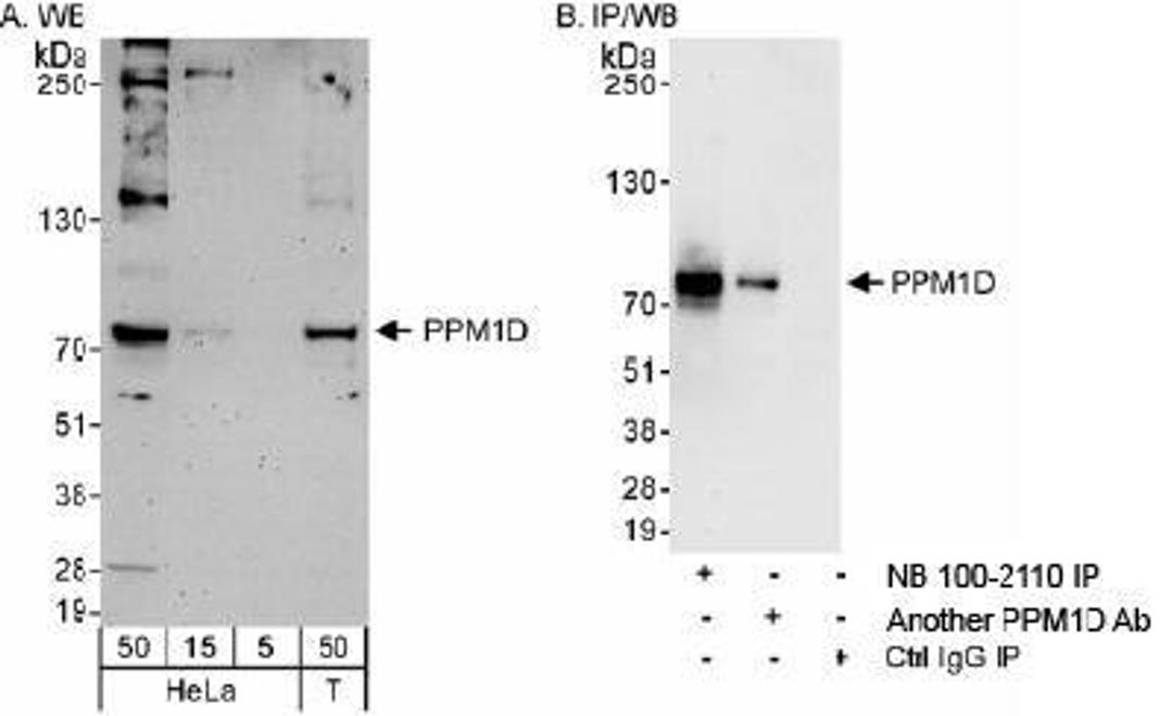 Western Blot: PPM1D Antibody [NB100-2110] - Detection of Human PPM1D on HeLa whole cell lysate using NB100-2110. PPM1D was also immunoprecipitated by another rabbit anti-PPM1D antibody.