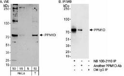 Western Blot: PPM1D Antibody [NB100-2110] - Detection of Human PPM1D on HeLa whole cell lysate using NB100-2110. PPM1D was also immunoprecipitated by another rabbit anti-PPM1D antibody.