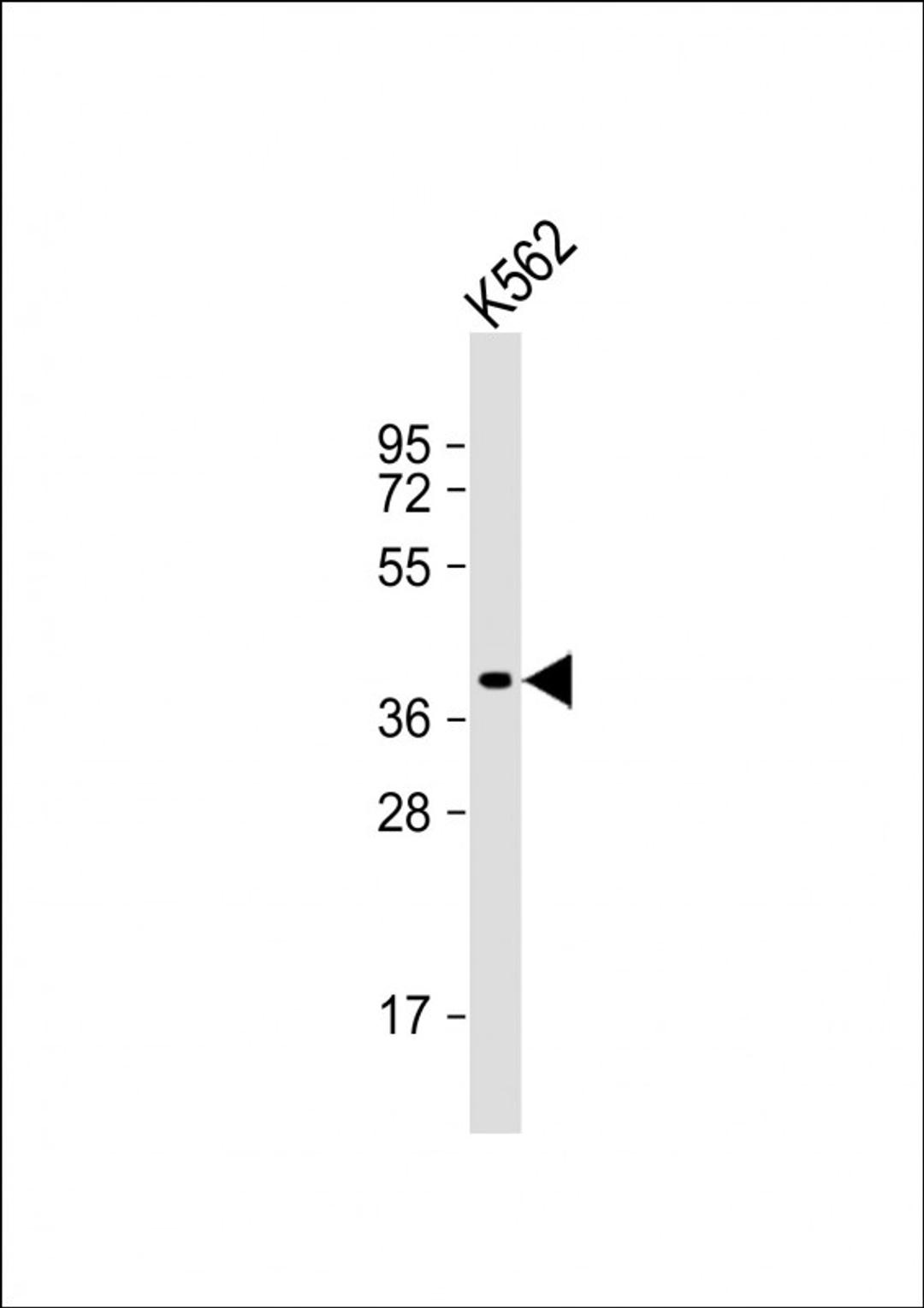 Western Blot at 1:1000 dilution + K562 whole cell lysate Lysates/proteins at 20 ug per lane.