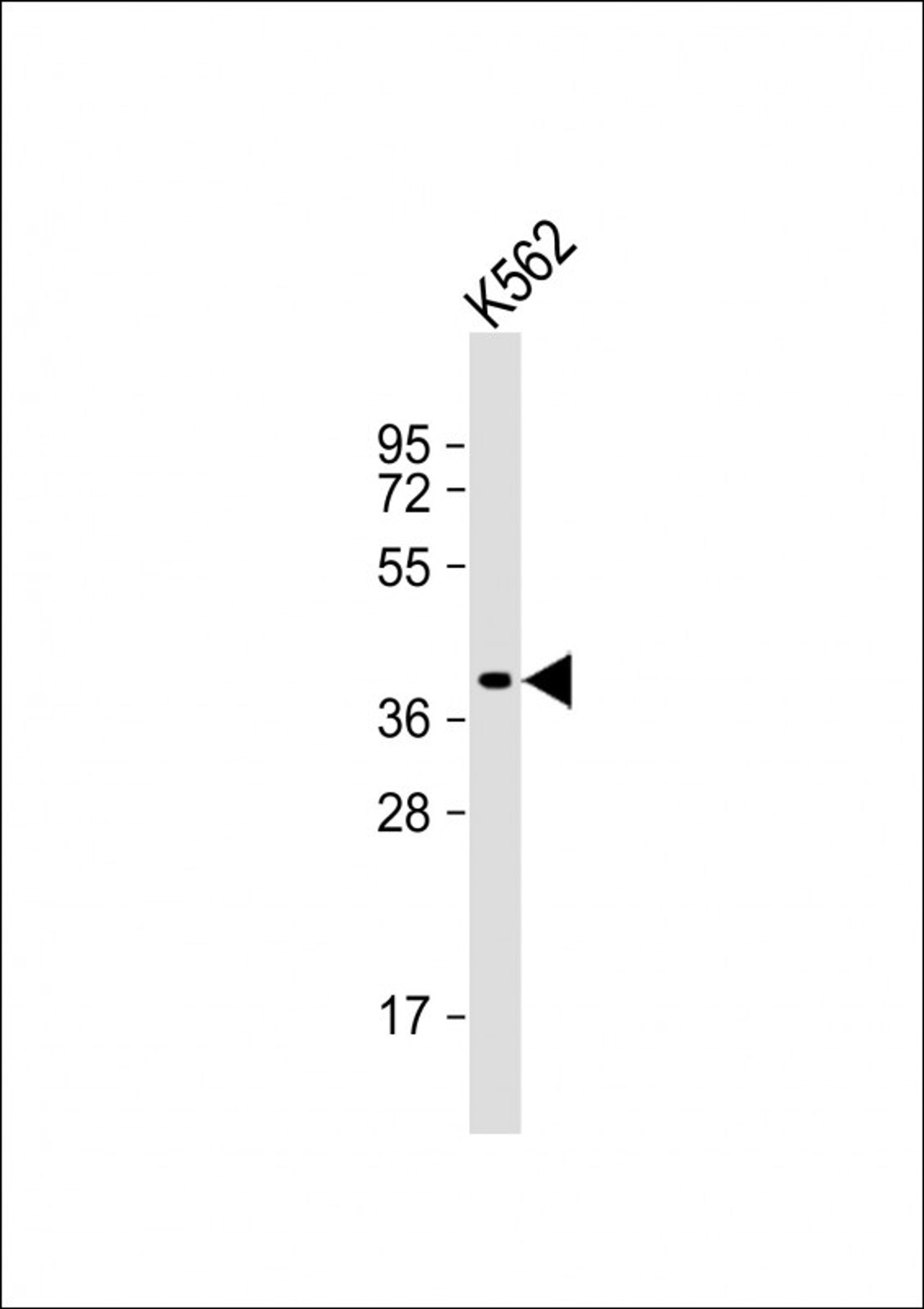 Western Blot at 1:1000 dilution + K562 whole cell lysate Lysates/proteins at 20 ug per lane.