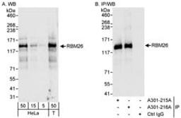 Detection of human RBM26 by western blot and immunoprecipitation.