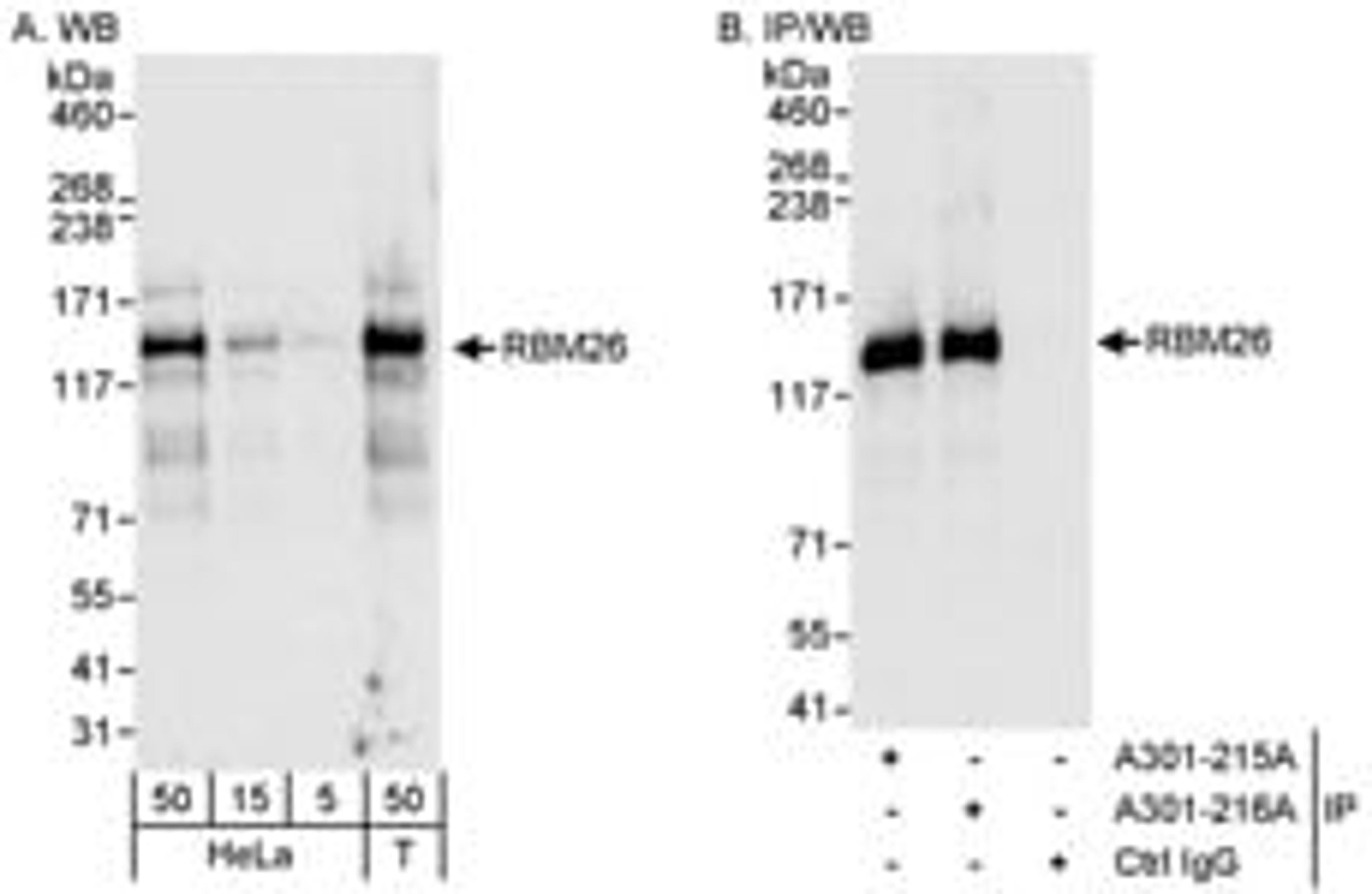 Detection of human RBM26 by western blot and immunoprecipitation.