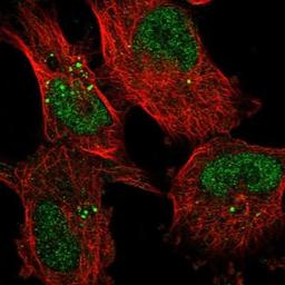 Immunocytochemistry/ Immunofluorescence: KDELC2 Antibody [NBP1-92047] - Staining of human cell line U-251 MG shows positivity in nucleus but not nucleoli & vesicles.