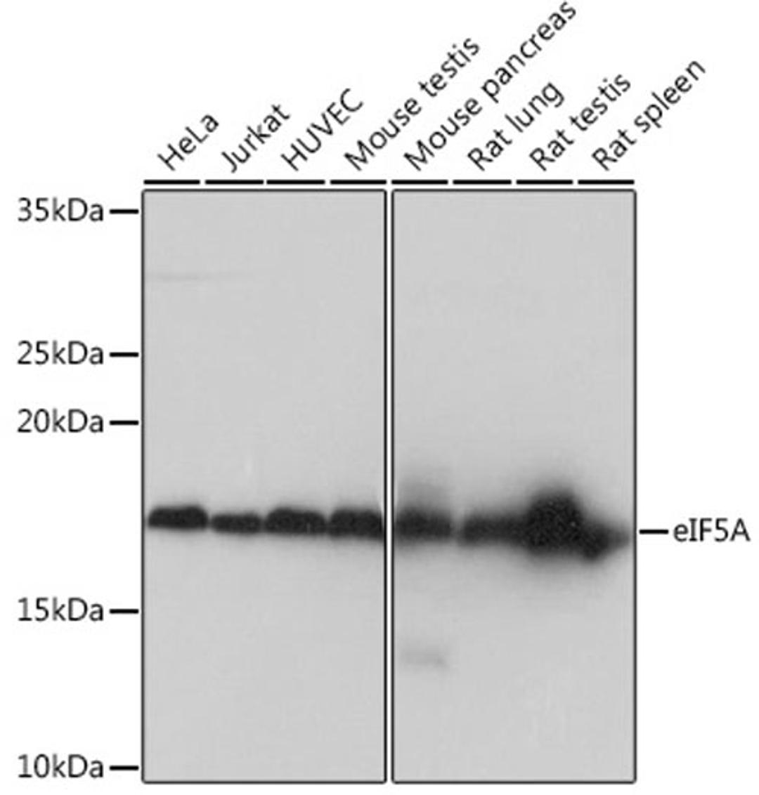 Western blot - eIF5A Rabbit mAb (A4414)