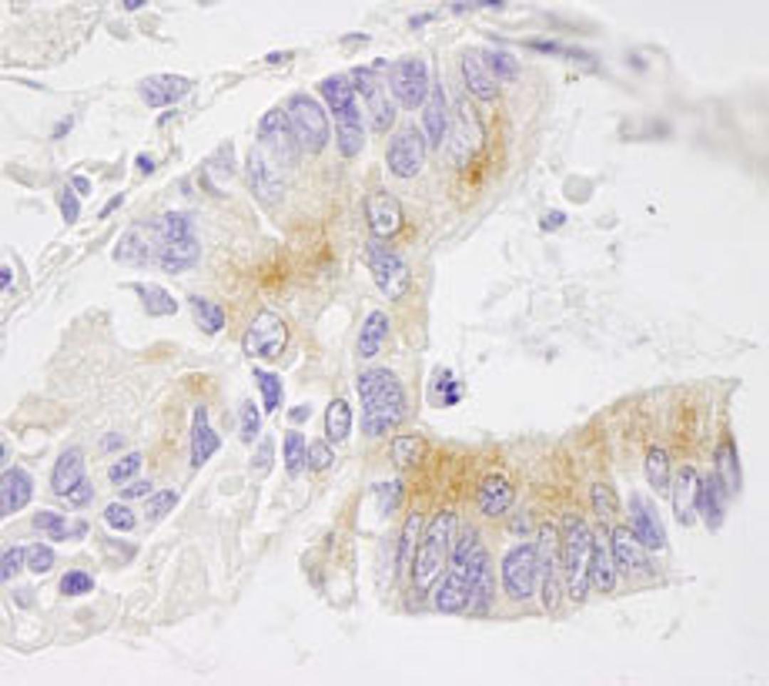 Detection of human EML4 by immunohistochemistry.