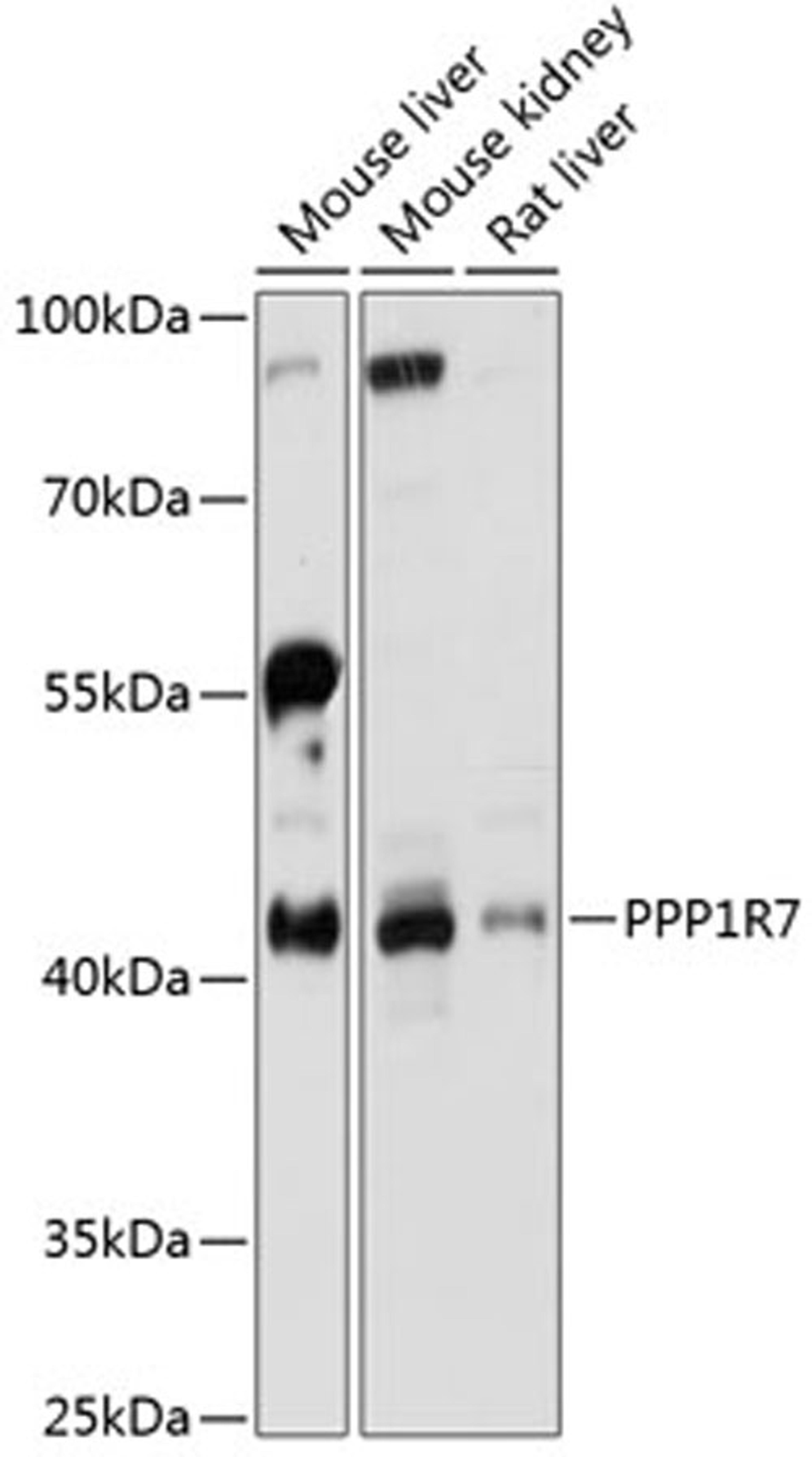 Western blot - PPP1R7 antibody (A13040)