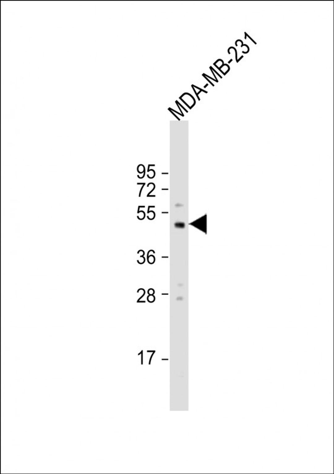 Western Blot at 1:500 dilution + MDA-MB-231 whole cell lysate Lysates/proteins at 20 ug per lane.