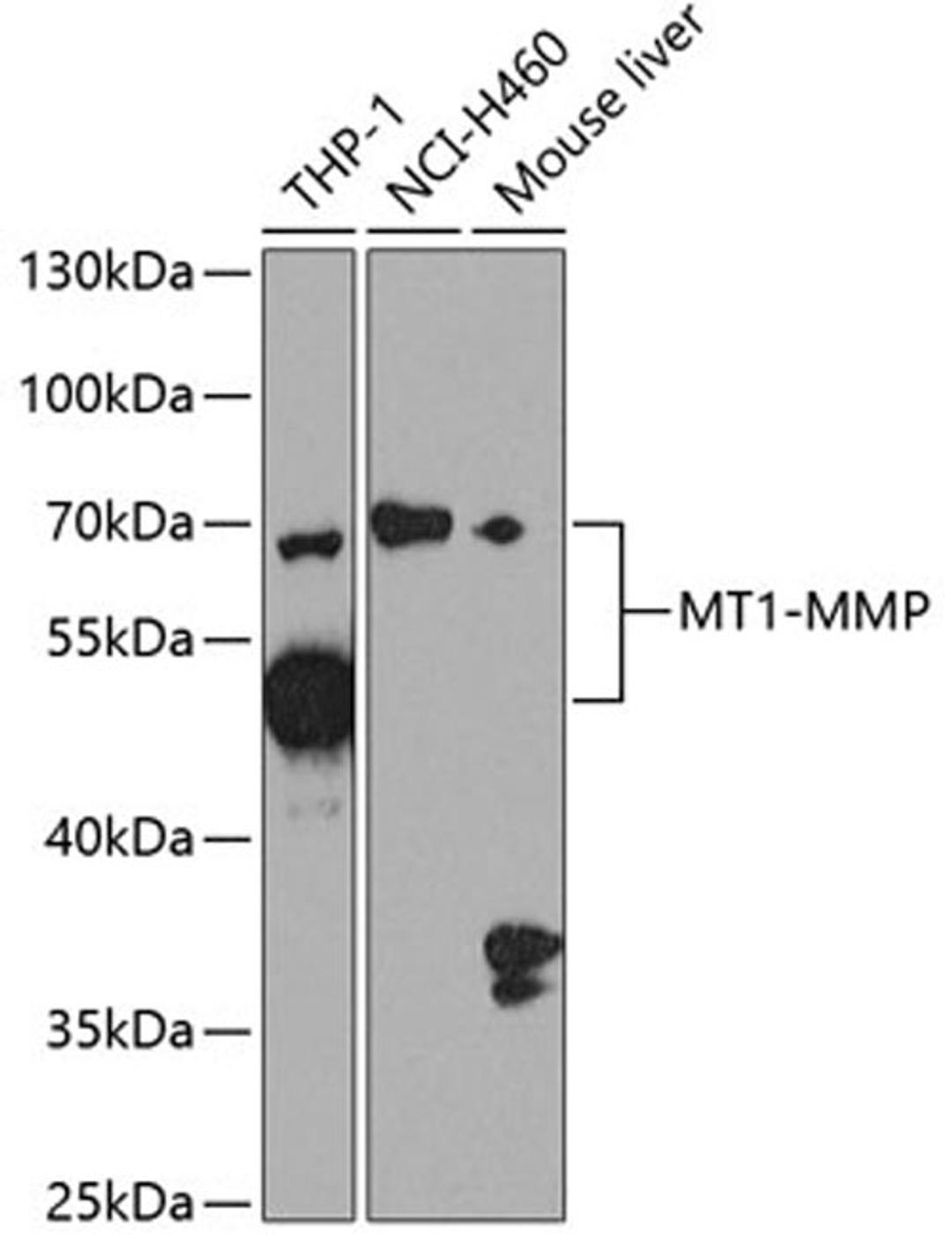 Western blot - MT1-MMP antibody (A2549)