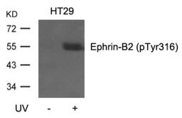 Western blot analysis of lysed extracts from HT29 cells, untreated or treated with UV using Ephrin-B2 (Phospho-Tyr316).