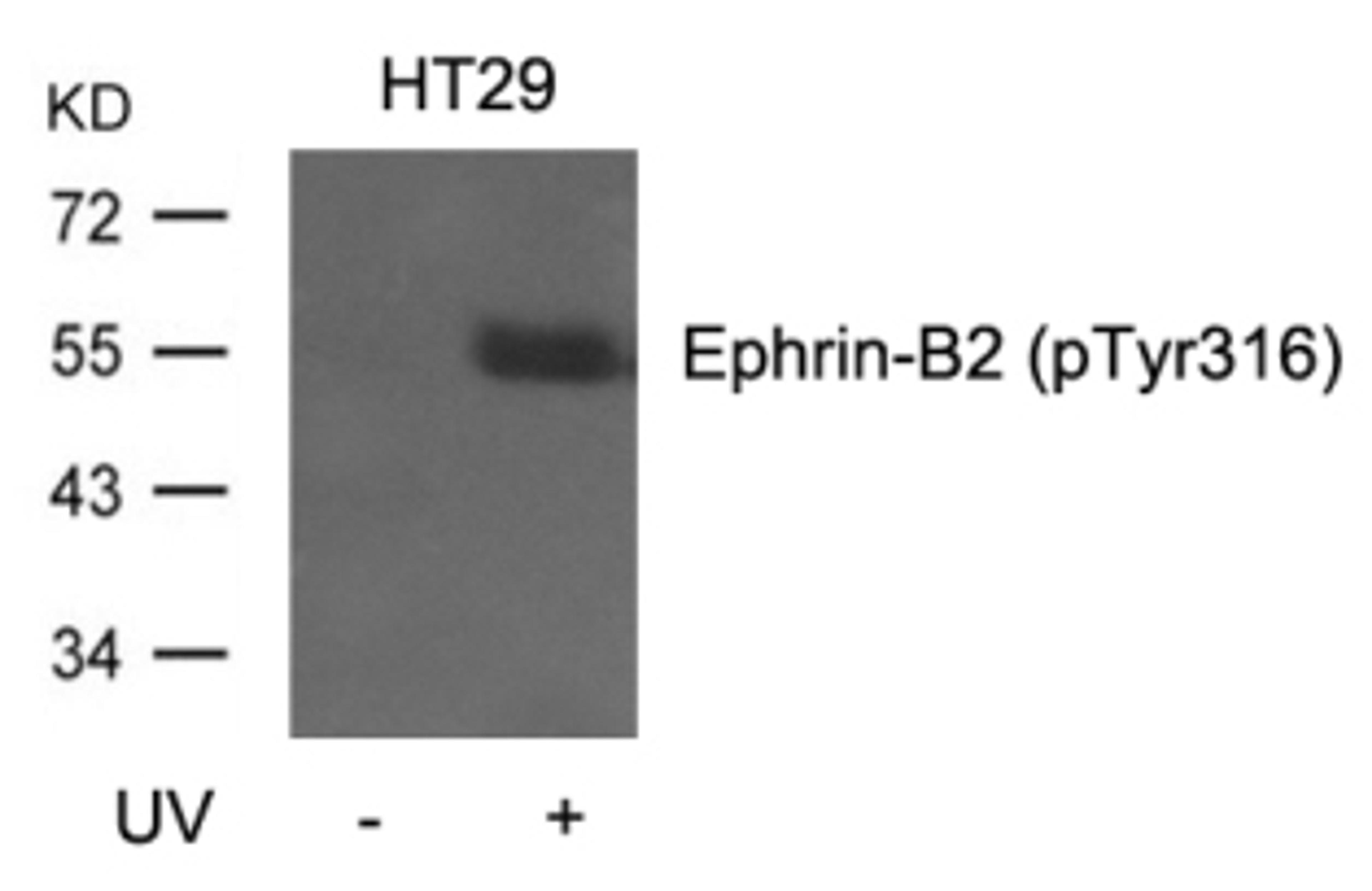 Western blot analysis of lysed extracts from HT29 cells, untreated or treated with UV using Ephrin-B2 (Phospho-Tyr316).