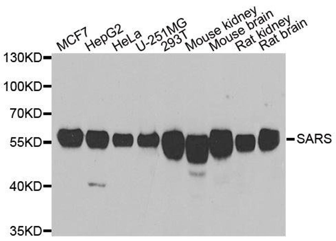 Western blot analysis of extracts of various cell lines using SARS antibody