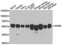 Western blot analysis of extracts of various cell lines using SARS antibody