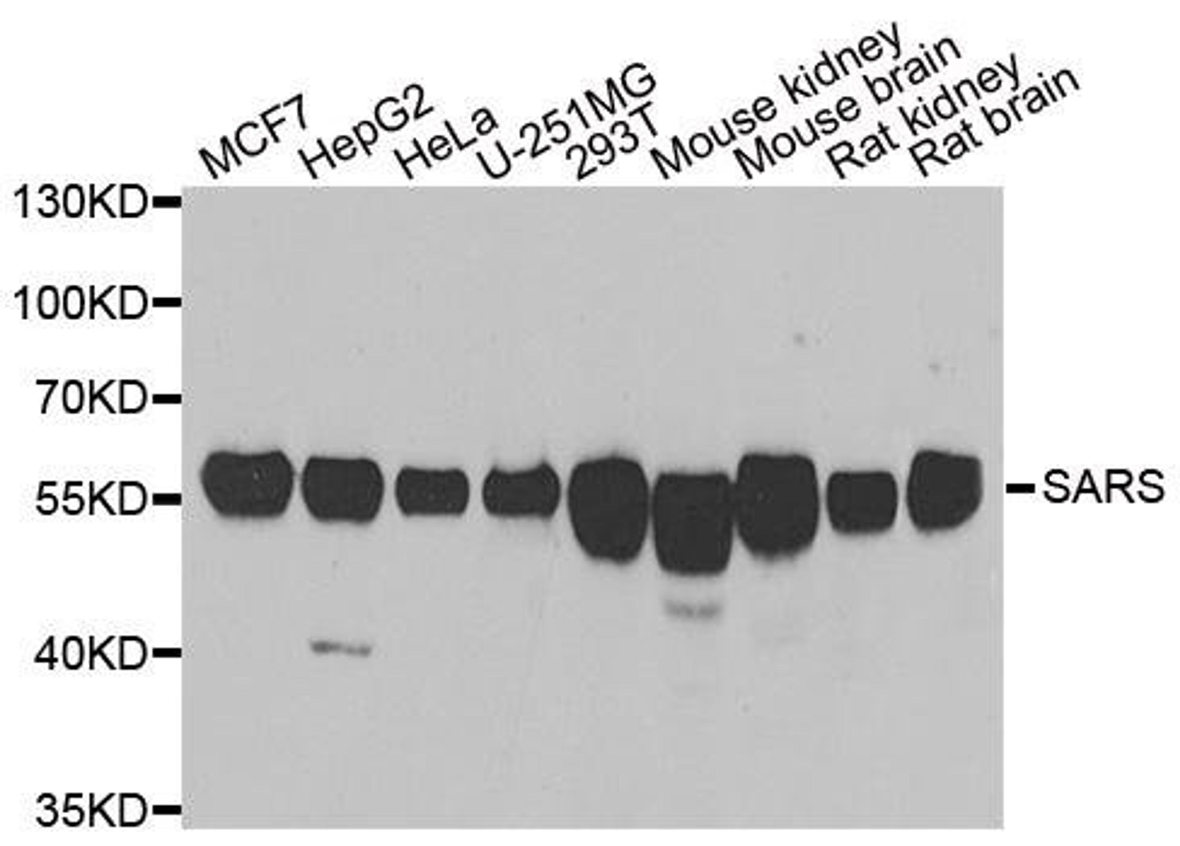 Western blot analysis of extracts of various cell lines using SARS antibody