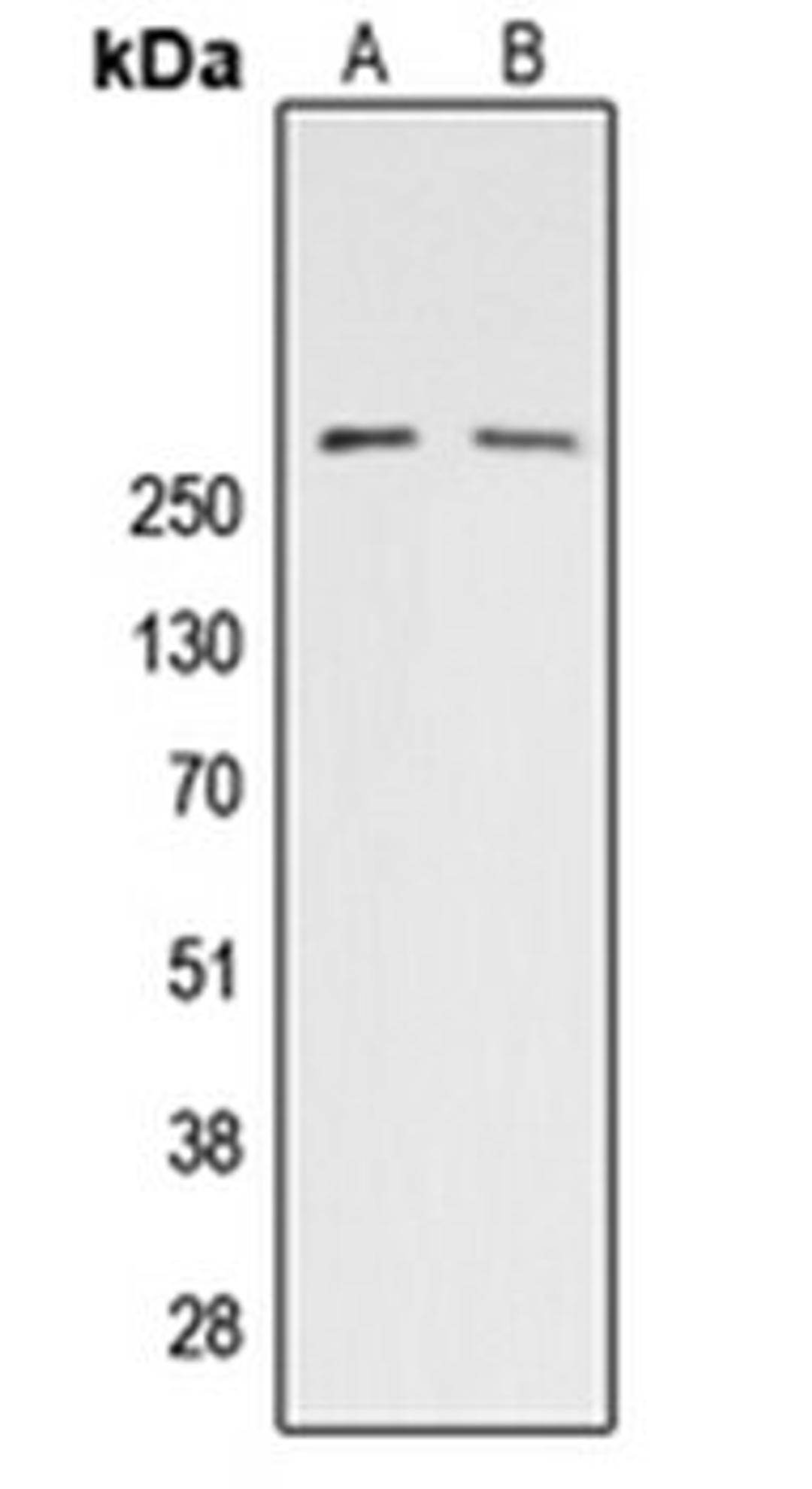 Western blot analysis of HeLa (Lane 1), NIH3T3 PMA-treated (Lane 2) whole cell lysates using ACC alpha (phospho-S80) antibody