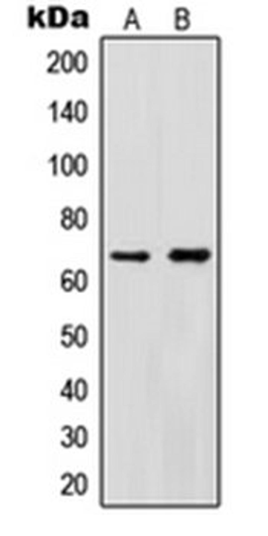 Western blot analysis of HeLa (Lane 1), HEK293T (Lane 2) whole cell lysates using IK antibody