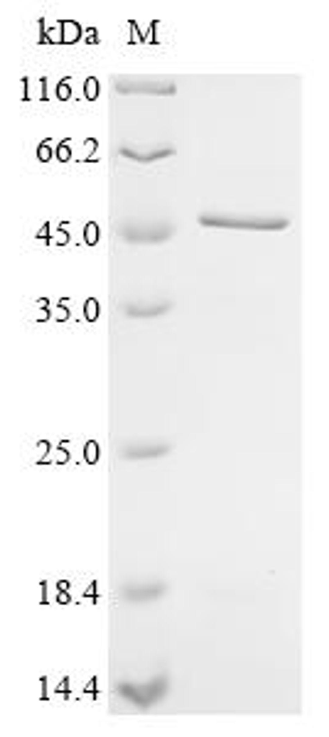 (Tris-Glycine gel) Discontinuous SDS-PAGE (reduced) with 5% enrichment gel and 15% separation gel.