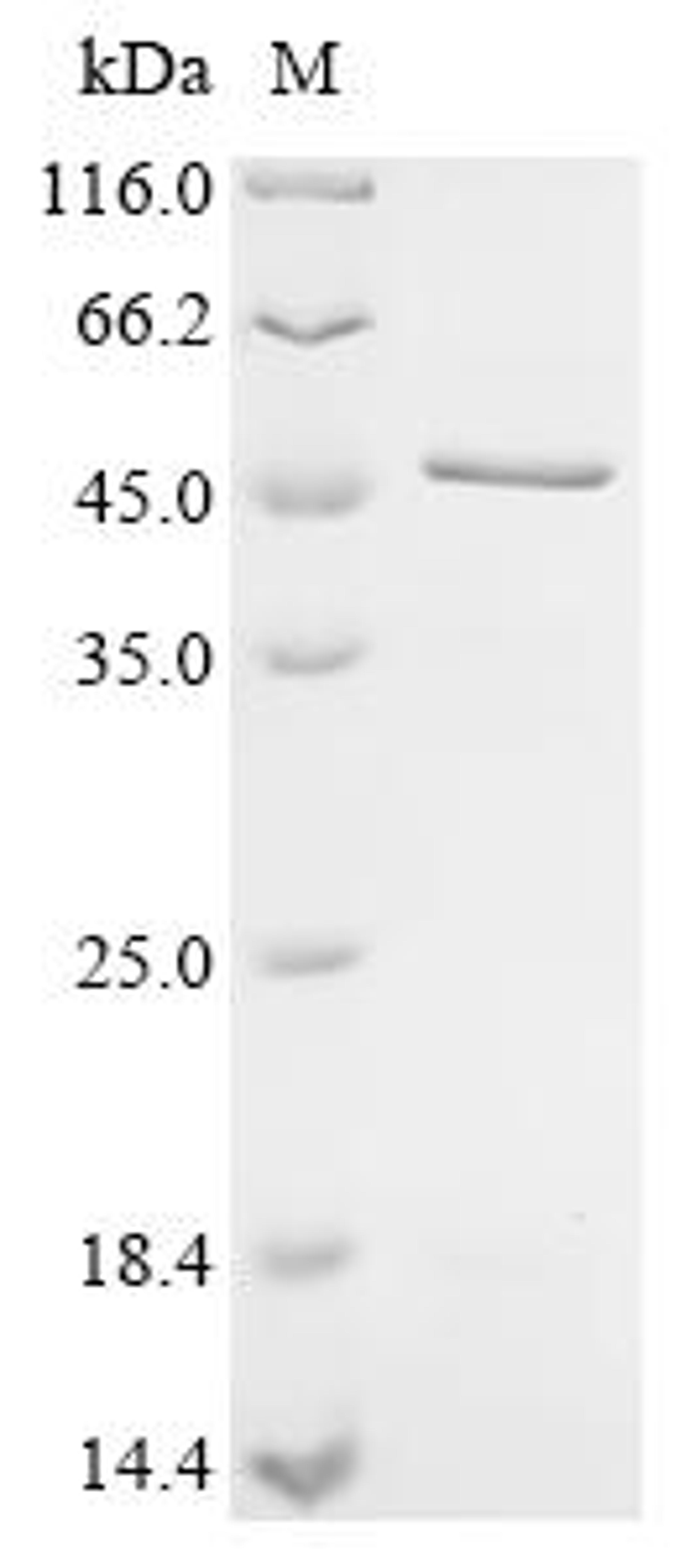 (Tris-Glycine gel) Discontinuous SDS-PAGE (reduced) with 5% enrichment gel and 15% separation gel.