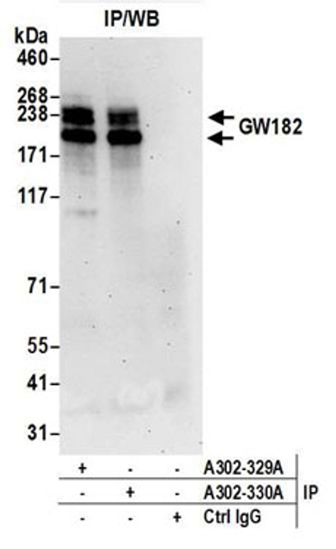 Detection of human GW182 by western blot of immunoprecipitates.