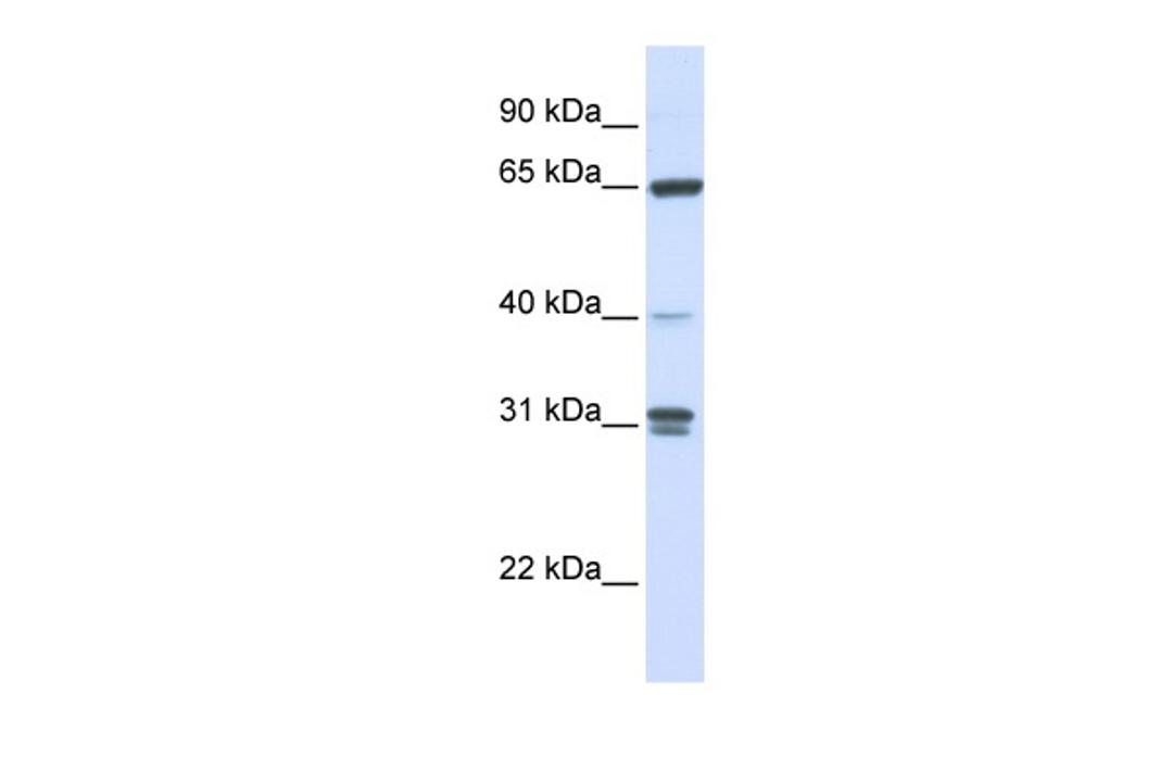 Antibody used in WB on Human 721_B at 0.2-1 ug/ml.